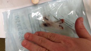 The splints that were in my nose, with Nick's hand by them for size comparison.